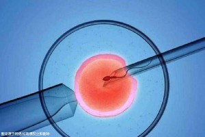 供卵代怀包男孩